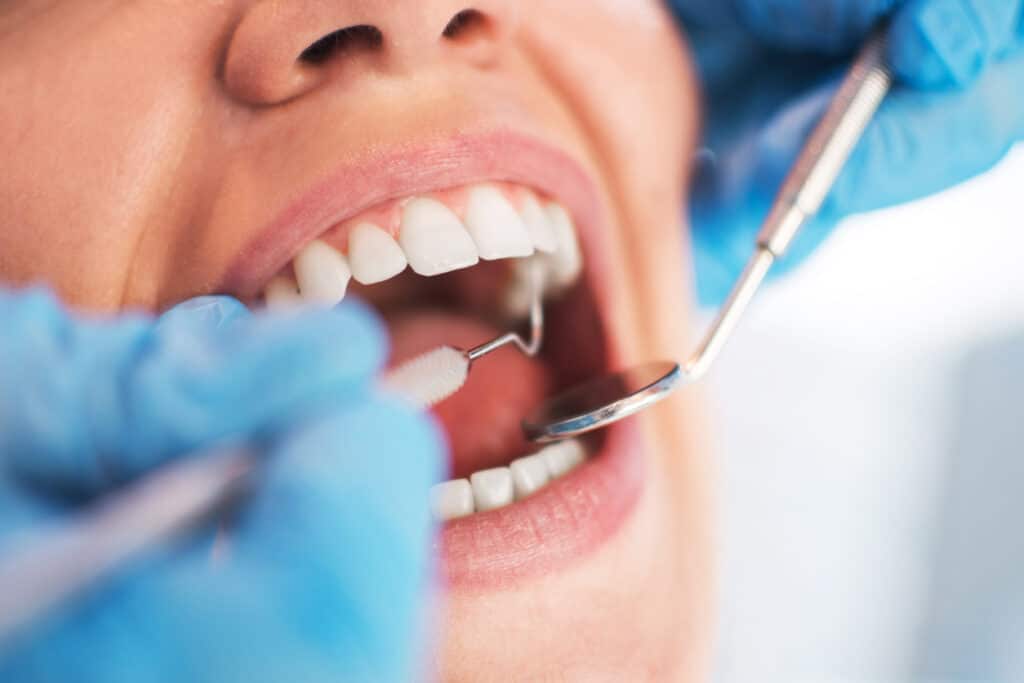 Patient receiving a dental checkup