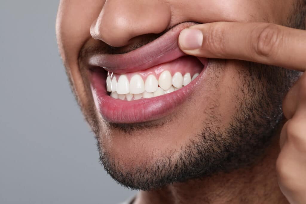 Patient showing their healthy pink gums